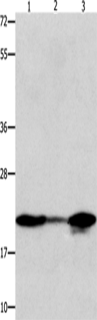 Anti-NM23A Rabbit Polyclonal Antibody