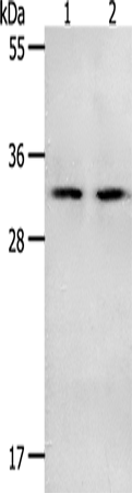 Anti-NME6 Rabbit Polyclonal Antibody