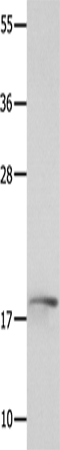 Anti-NME3 Rabbit Polyclonal Antibody
