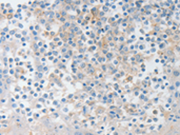 Anti-NT 4 Rabbit Polyclonal Antibody