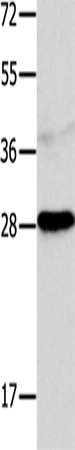 Anti-NT 4 Rabbit Polyclonal Antibody