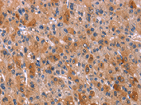 Anti-NR4A2 Rabbit Polyclonal Antibody