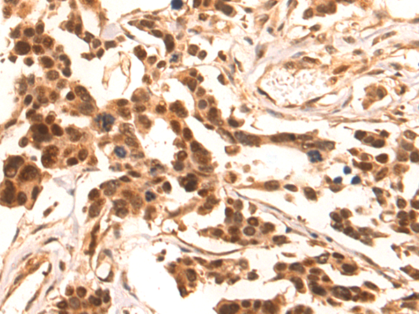 Anti-Oct-2 Rabbit Polyclonal Antibody