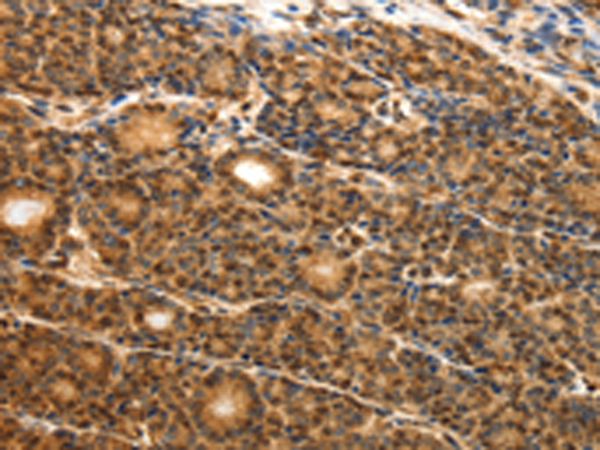 Anti-ODC1 Rabbit Polyclonal Antibody