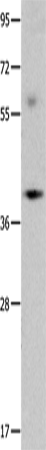 Anti-OPCML Rabbit Polyclonal Antibody