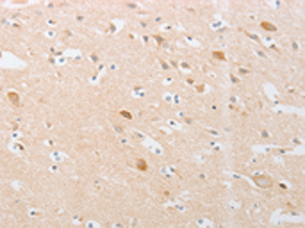 Anti-CDKN2AIP Rabbit Polyclonal Antibody