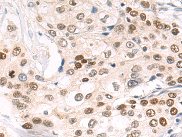 Anti-p73 Rabbit Polyclonal Antibody