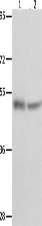 Anti-p73 Rabbit Polyclonal Antibody