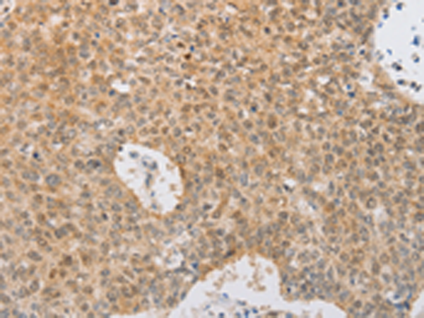 Anti-SERPINE2 Rabbit Polyclonal Antibody