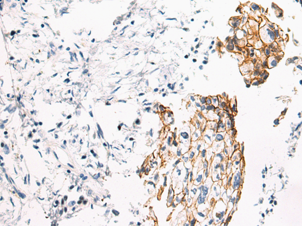 Anti-P cadherin Rabbit Polyclonal Antibody