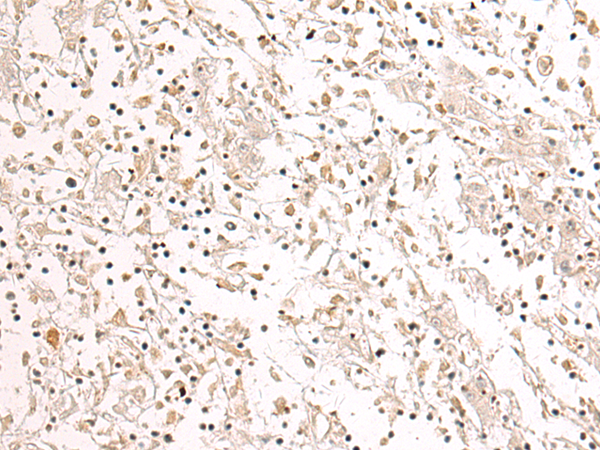 Anti-SPDEF Rabbit Polyclonal Antibody