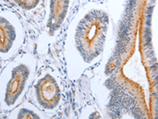 Anti-uPA Receptor Rabbit Polyclonal Antibody