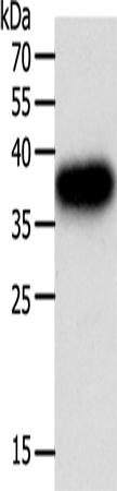 Anti-uPA Receptor Rabbit Polyclonal Antibody