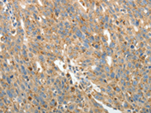 Anti-PRCP Rabbit Polyclonal Antibody