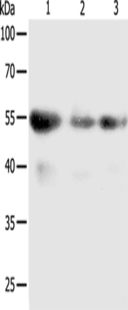 Anti-PRCP Rabbit Polyclonal Antibody