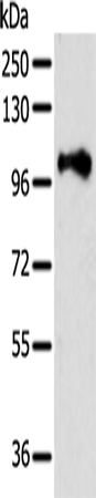 Anti-Proteasome S2 Rabbit Polyclonal Antibody
