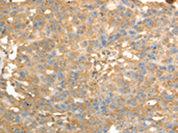 Anti-PSMD9 Rabbit Polyclonal Antibody