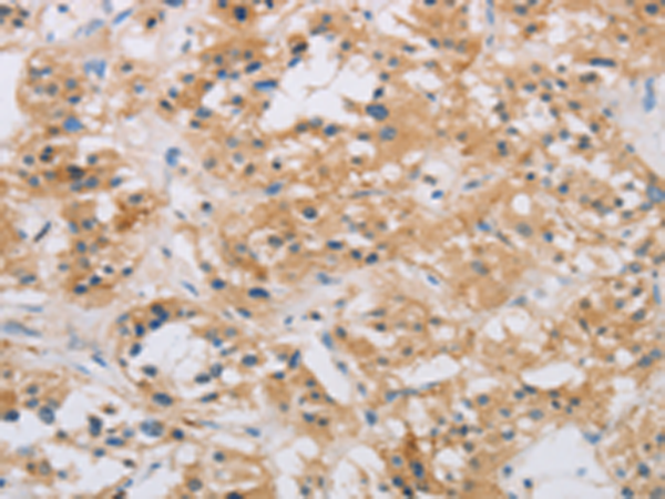 Anti-Rad54L2 Rabbit Polyclonal Antibody