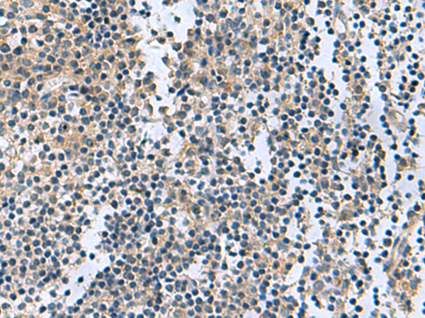 Anti-RGS2 Rabbit Polyclonal Antibody
