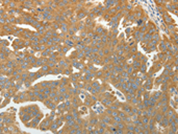 Anti-RPLP0 Rabbit Polyclonal Antibody