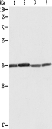 Anti-RPLP0 Rabbit Polyclonal Antibody