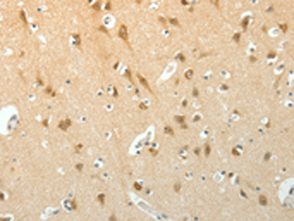 Anti-SCG3 Rabbit Polyclonal Antibody