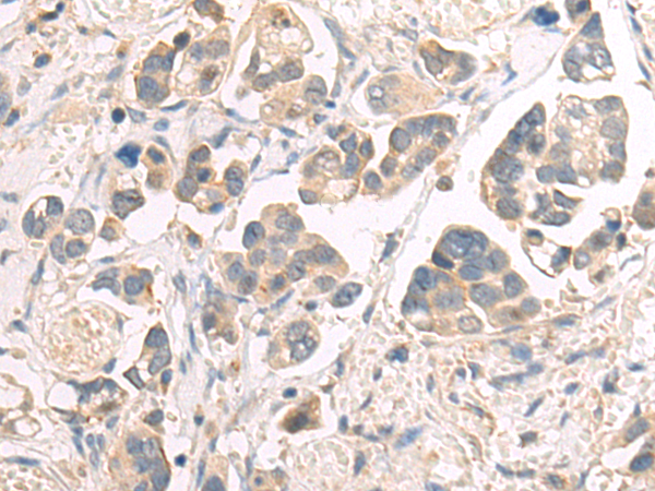 Anti-SHP2 Rabbit Polyclonal Antibody