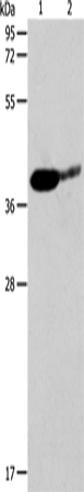 Anti-SIRT3 Rabbit Polyclonal Antibody