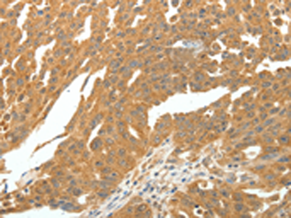 Anti-SKP1 Rabbit Polyclonal Antibody
