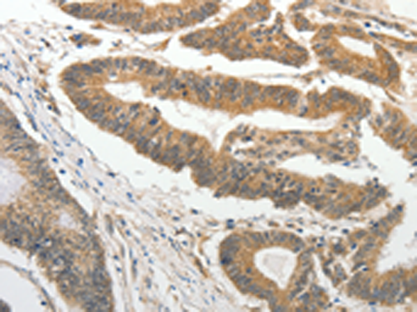 Anti-SLC4A4 Rabbit Polyclonal Antibody
