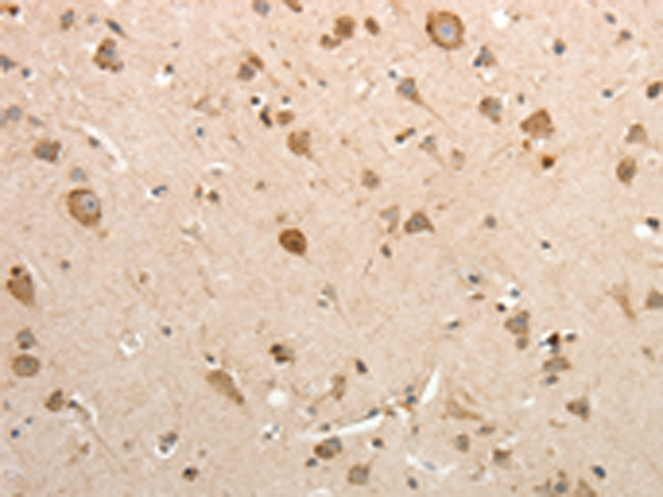 Anti-SLC12A1 Rabbit Polyclonal Antibody