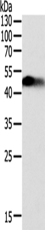 Anti-SLC12A1 Rabbit Polyclonal Antibody