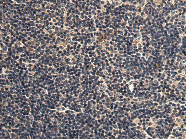 Anti-Transgelin 2 Rabbit Polyclonal Antibody