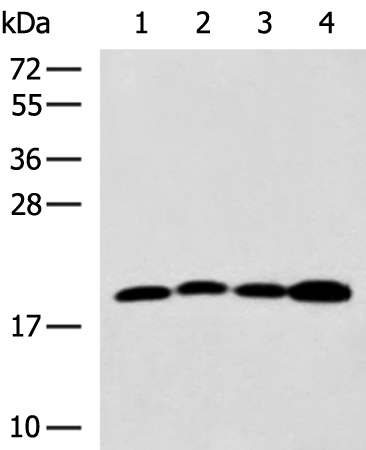 Anti-Transgelin 2 Rabbit Polyclonal Antibody