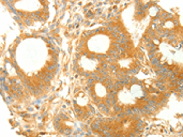 Anti-NAPA Rabbit Polyclonal Antibody