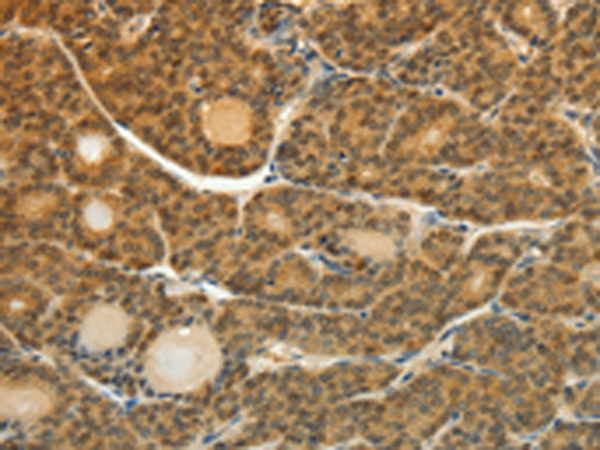 Anti-SOCS5 Rabbit Polyclonal Antibody