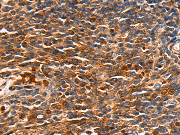 Anti-SOCS6 Rabbit Polyclonal Antibody