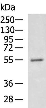 Anti-SOCS6 Rabbit Polyclonal Antibody