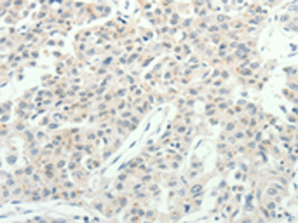 Anti-RPAP3 Rabbit Polyclonal Antibody