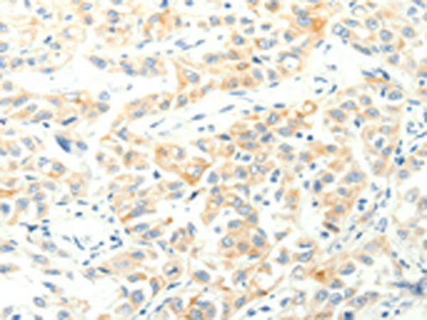 Anti-SPAG5 Rabbit Polyclonal Antibody