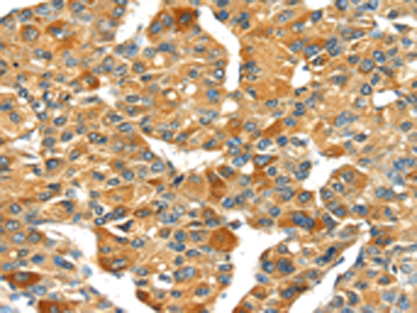 Anti-SPARC Rabbit Polyclonal Antibody