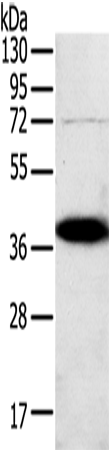 Anti-SPARC Rabbit Polyclonal Antibody