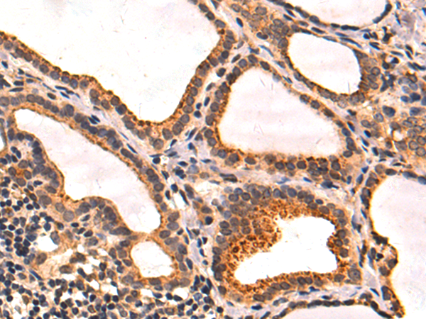 Anti-Spindlin 1 Rabbit Polyclonal Antibody
