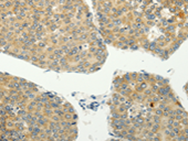 Anti-Spindlin 4 Rabbit Polyclonal Antibody