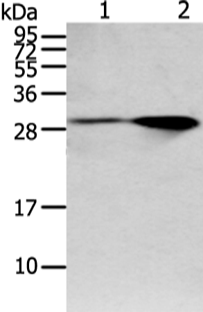 Anti-Spindlin 4 Rabbit Polyclonal Antibody