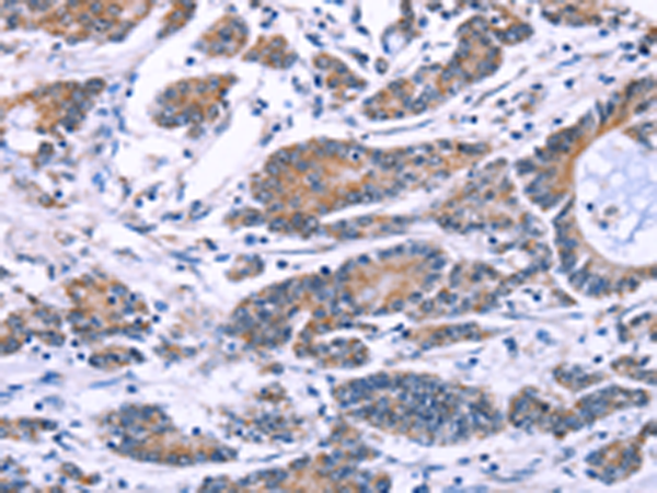 Anti-Synaptotagmin 4 Rabbit Polyclonal Antibody