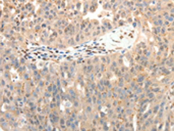 Anti-Synaptotagmin 7 Rabbit Polyclonal Antibody
