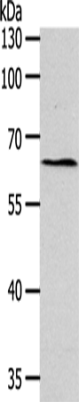 Anti-Synaptotagmin 7 Rabbit Polyclonal Antibody