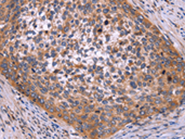 Anti-SPATA7 Rabbit Polyclonal Antibody