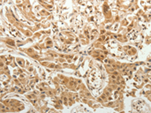 Anti-SPATA17 Rabbit Polyclonal Antibody